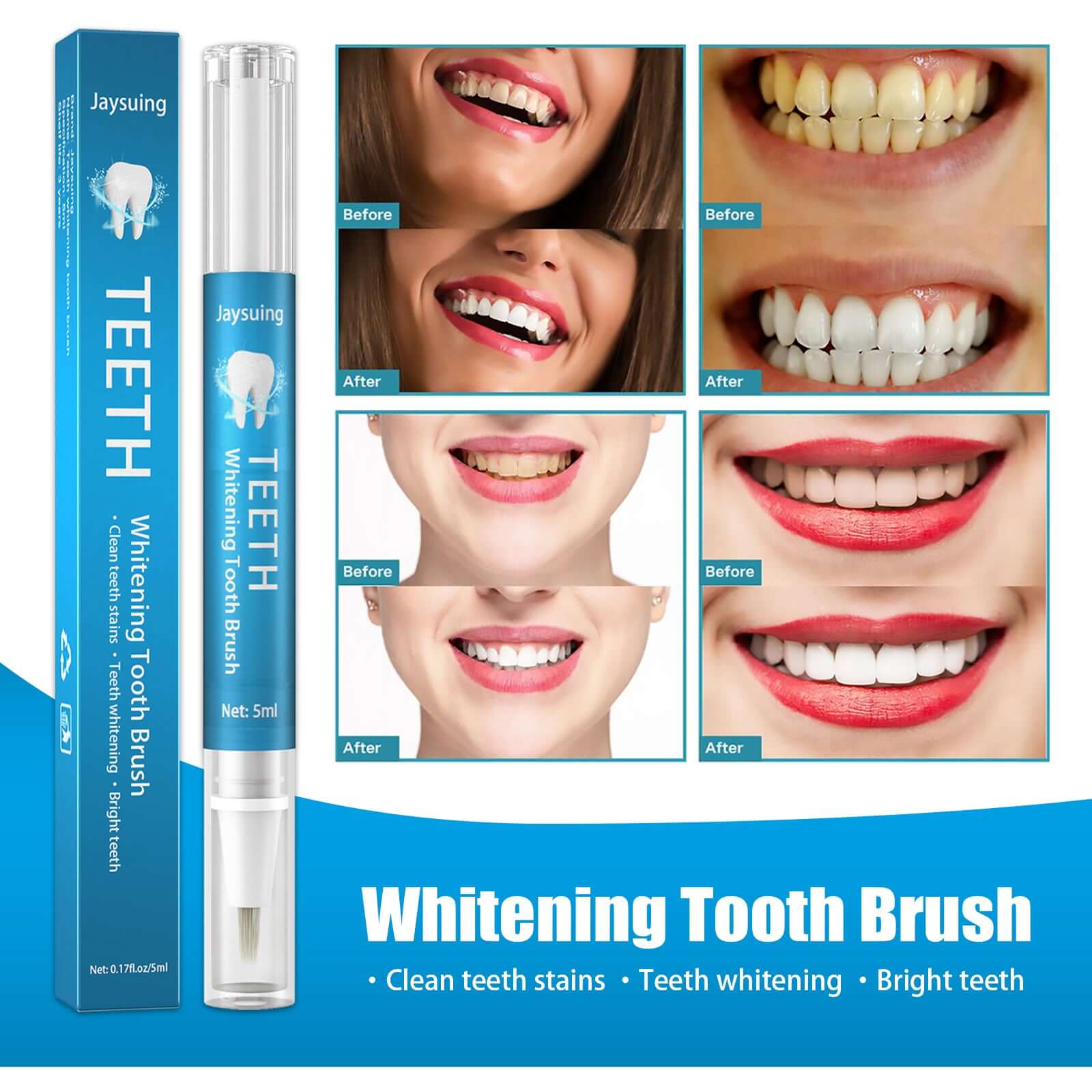 Jaysuing Whitening Tooth Brush pen with before and after teeth whitening results.