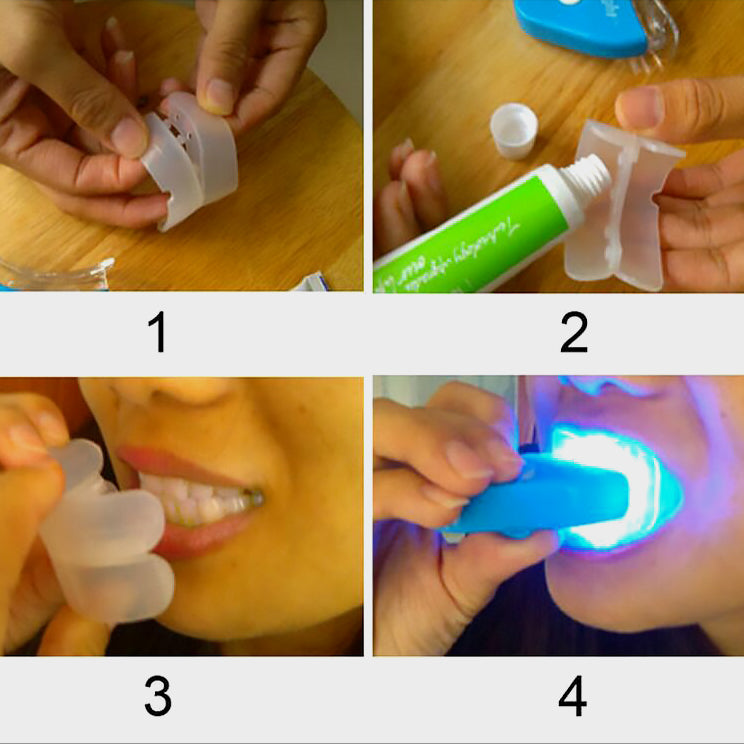 Step-by-step guide for applying teeth whitening gel using a mouth tray and LED light.