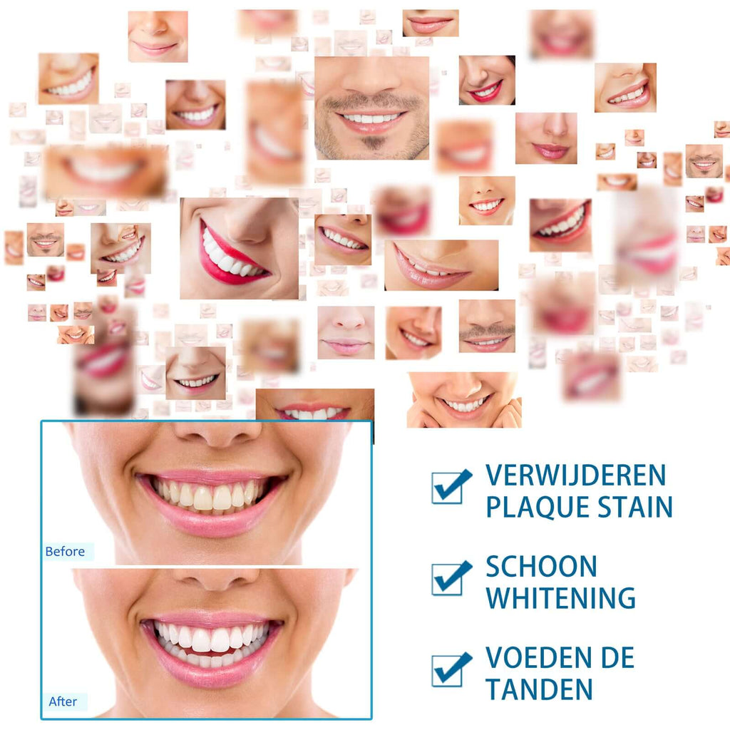 Before and after comparison of teeth whitening and plaque removal results.