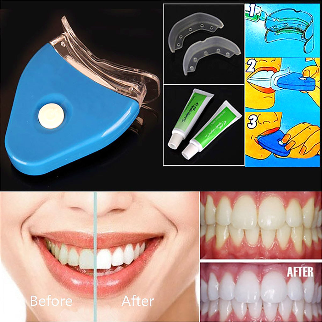 Teeth whitening kit with blue applicator, whitening gels, and before and after results.